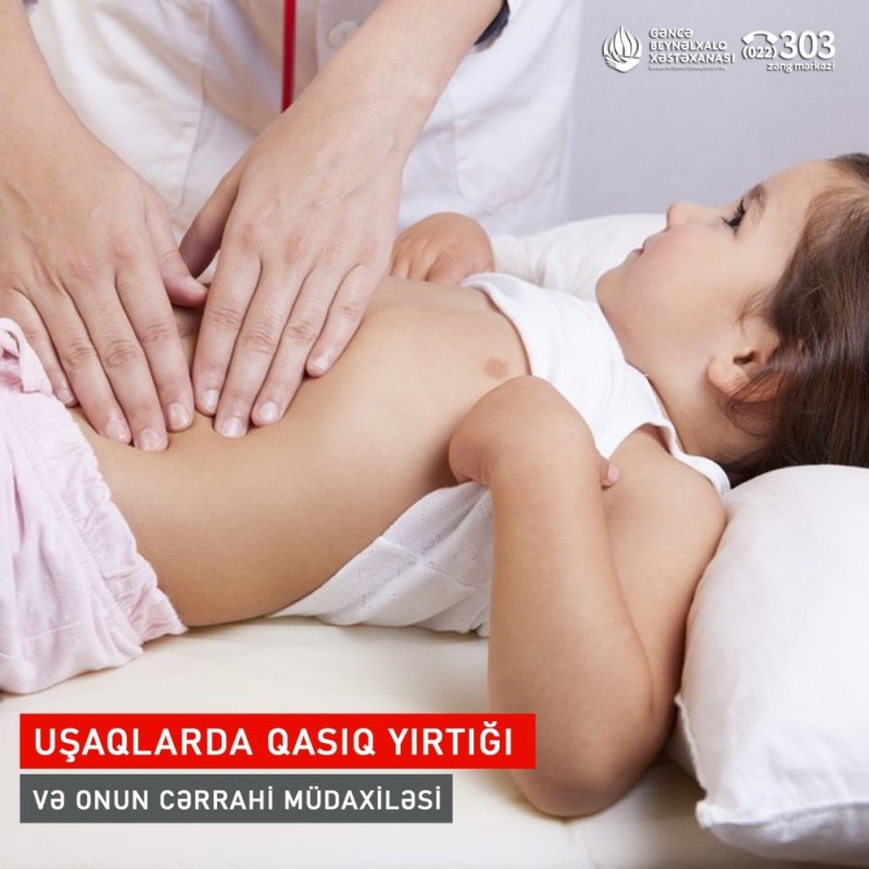 Uşaqlarda qasıq yırtığı və onun cərrahi müdaxiləsi.