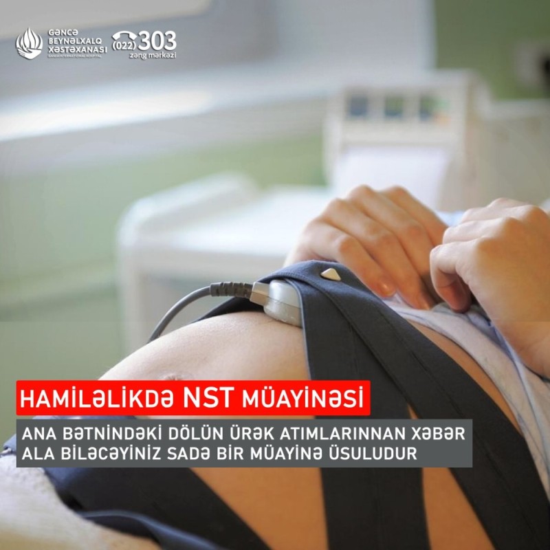 Hamiləlikdə NST müayinəsi