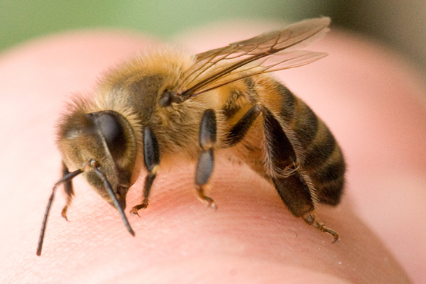 Böcək allergiyası