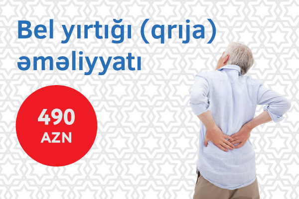 Bel yırtığından (qrıjadan) əziyyət çəkənlərə sevindirici xəbər