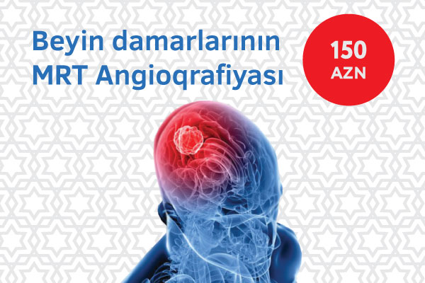 Beyin damarları MRT Angioqrafiyası - 150 AZN