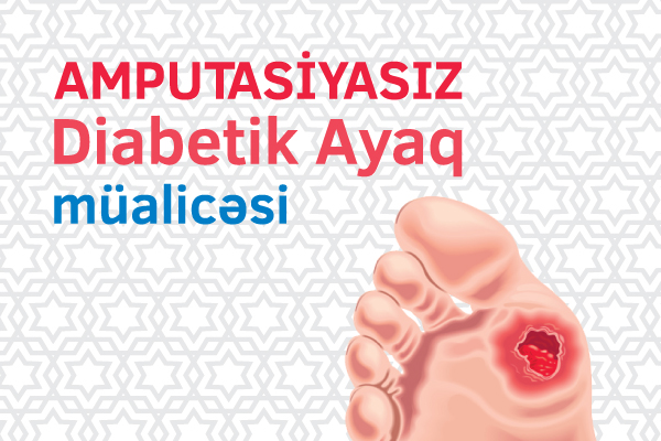 Diabetik ayaq müalicəsi